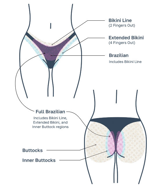 brazilian-laser-hair-removal-nyc