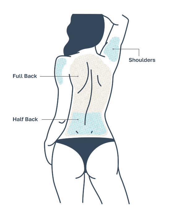 laser-hair-removal-nyc-back